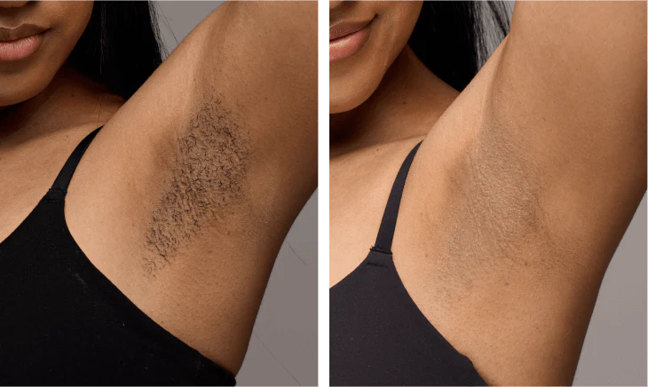 Property_1_US_-Air10-Destinee-Armpits-364x218_730x