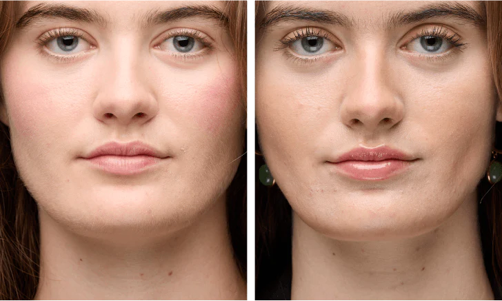 Property_1_US_-Air10--Kiara-Face-364x218_728x