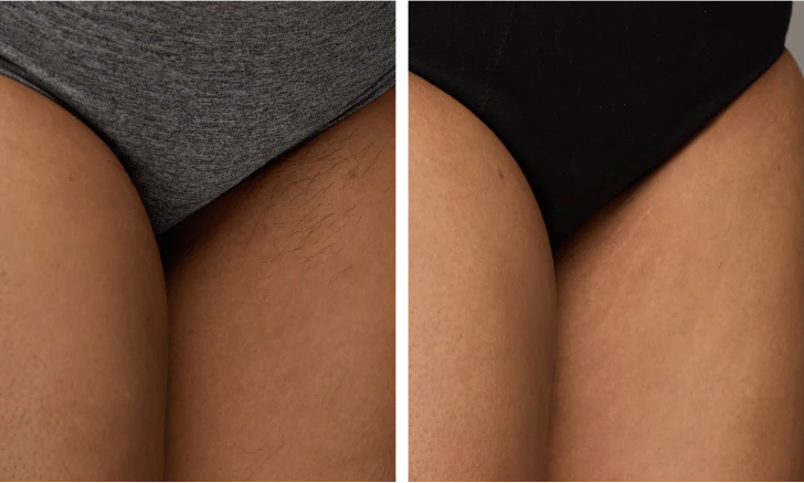 Property_1_US_-Air10-Swetha-Bikini-364x218_728x