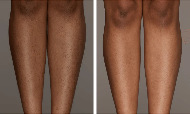 Property_1_US_-Air10-Swetha-Legs-364x218_728x