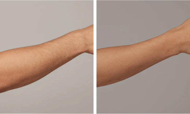 Property_1_US_-Air3-Makaio_Michaels_-Arms_728x