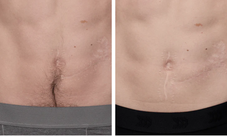 US_-Ulike_X-Noah-Stomach-364x218_728x